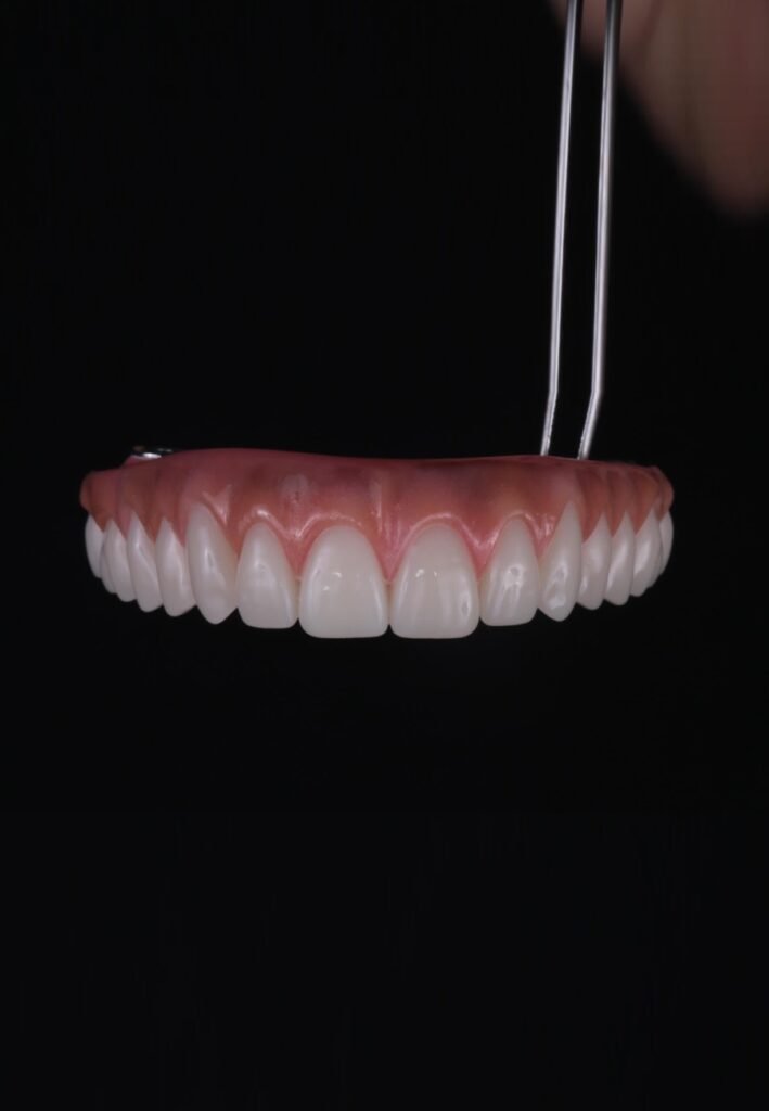 zigomatico-7